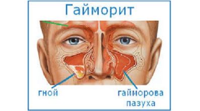 Болит спина и температура к какому врачу