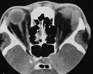 Болит спина и температура к какому врачу