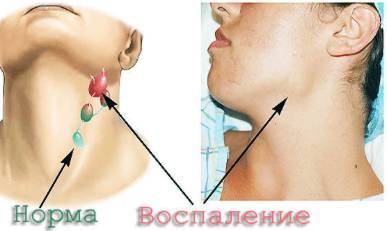 Болит спина и температура к какому врачу