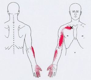 Точки спины где что болит