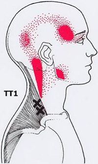 Точки спины где что болит