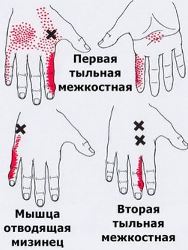 Точки спины где что болит