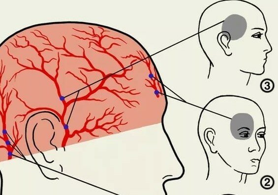 Болят глаза а потом голова