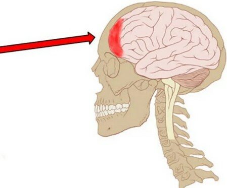 Если сильно болит голова в лобовой части