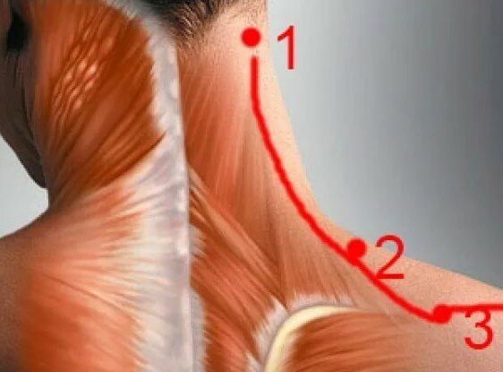 К какому врачу обращаться если болит спина и шея