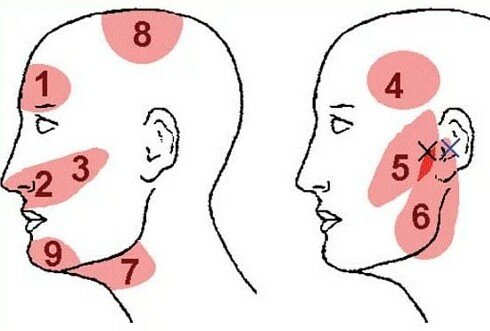 Если часто болит голова виски