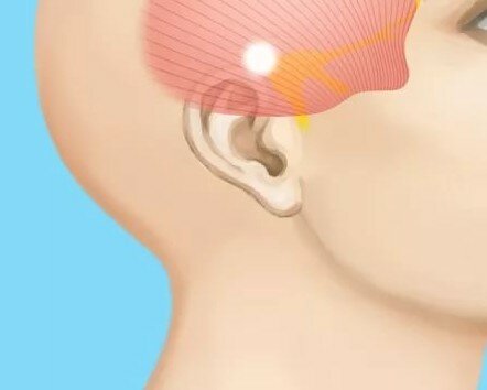 Болит голова в правом виске отдает в правый глаз