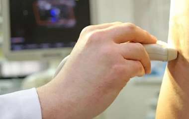 УЗДГ (дуплексное сканирование)