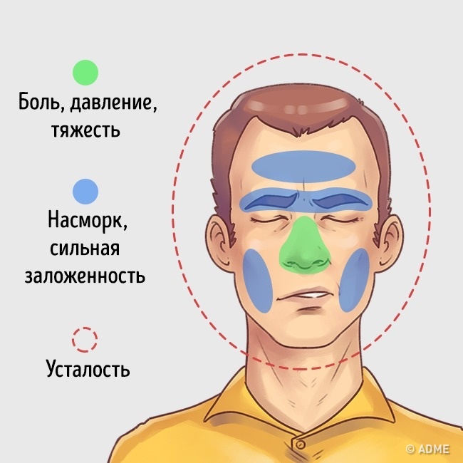 Болит голова и челюстной сустав
