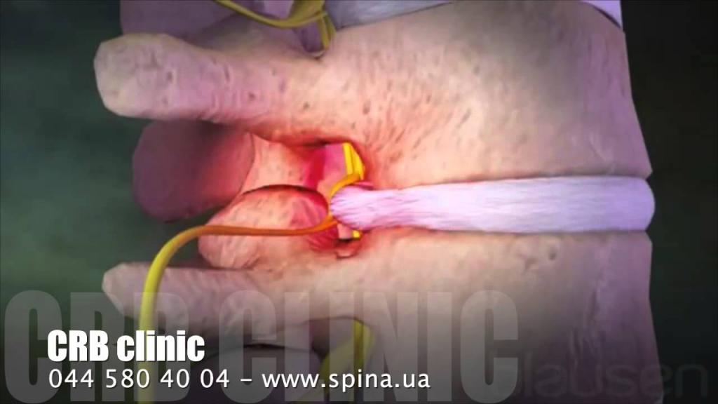 Когда болит нижняя часть спины