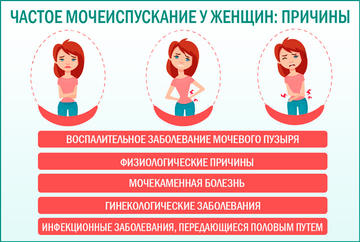 Хожу часто в туалет по маленькому и низ живота болит и болит спина