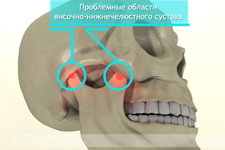 Болит голова и челюстной сустав