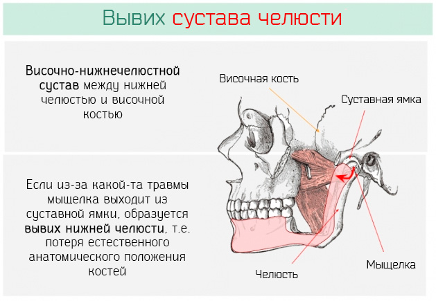 Болит голова и челюстной сустав