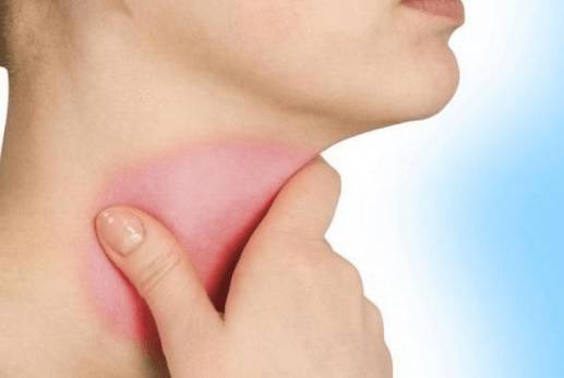 Если болит горло и голова может быть температура