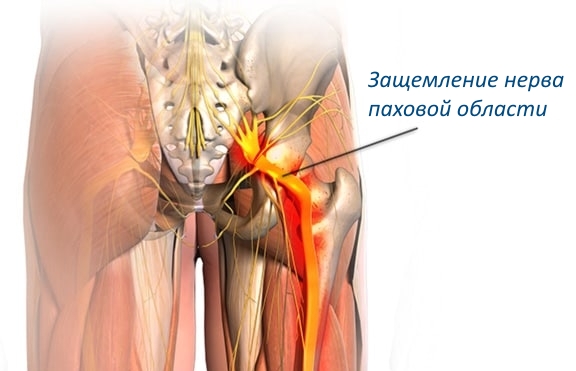 Болит спина в области поясницы слева у мужчин
