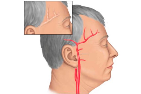 что делать если ужасно болит голова таблетки не помогают