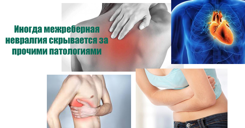 Mezhrebernaya nevralgiya mozhet proyavlyat'sya v vide boleznennykh oshchushcheniy so spiny Межреберная невралгия может проявляться в виде болезненных ощущений со спины, в позвоночнике или отдавать под лопатку, также могут возникать неприятные ощущения в животе и в области сердца.