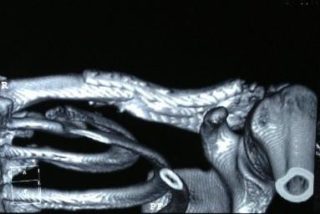 Болит ключица слева и голова