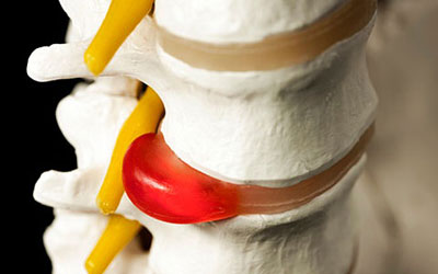 Спина болит с одной стороны особенно по ночам