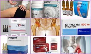 Болит ключица слева и голова