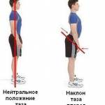 передний наклон таза