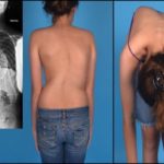 Болит грудь отдает в спину при вдохе