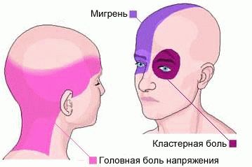 что делать если ужасно болит голова таблетки не помогают