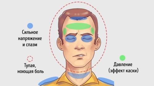 Головная боль напряжения – частая «спутница» шейных грыж Головная боль напряжения – частая «спутница» шейных грыж