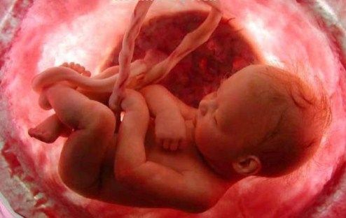 Многие специалисты сходятся в том, что свое начало дисплазия суставов у детей берет еще во внутриутробный период. Многие специалисты сходятся в том, что свое начало дисплазия суставов у детей берет еще во внутриутробный период.