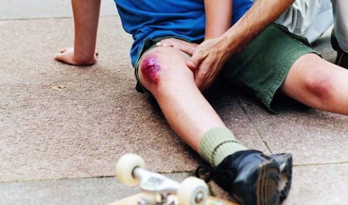 При любых повреждениях кожи на сочленениях, смесь лед + соль – противопоказана. При любых повреждениях кожи на сочленениях, смесь лед + соль – противопоказана.