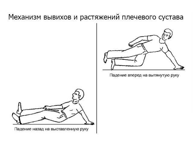 Воспаление плечевого сочленения может быть последствием травм. Воспаление плечевого сочленения может быть последствием травм.